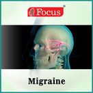 Migraine - An Overview
