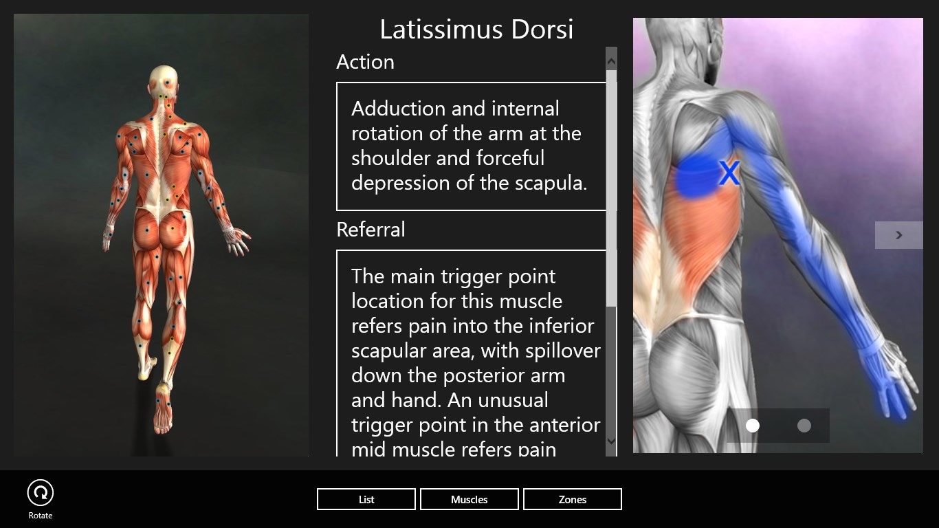 Pain down the arm from latissimus trigger points