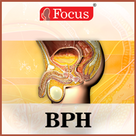 Benign Prostatic Hyperplasia (BPH) - An Overview