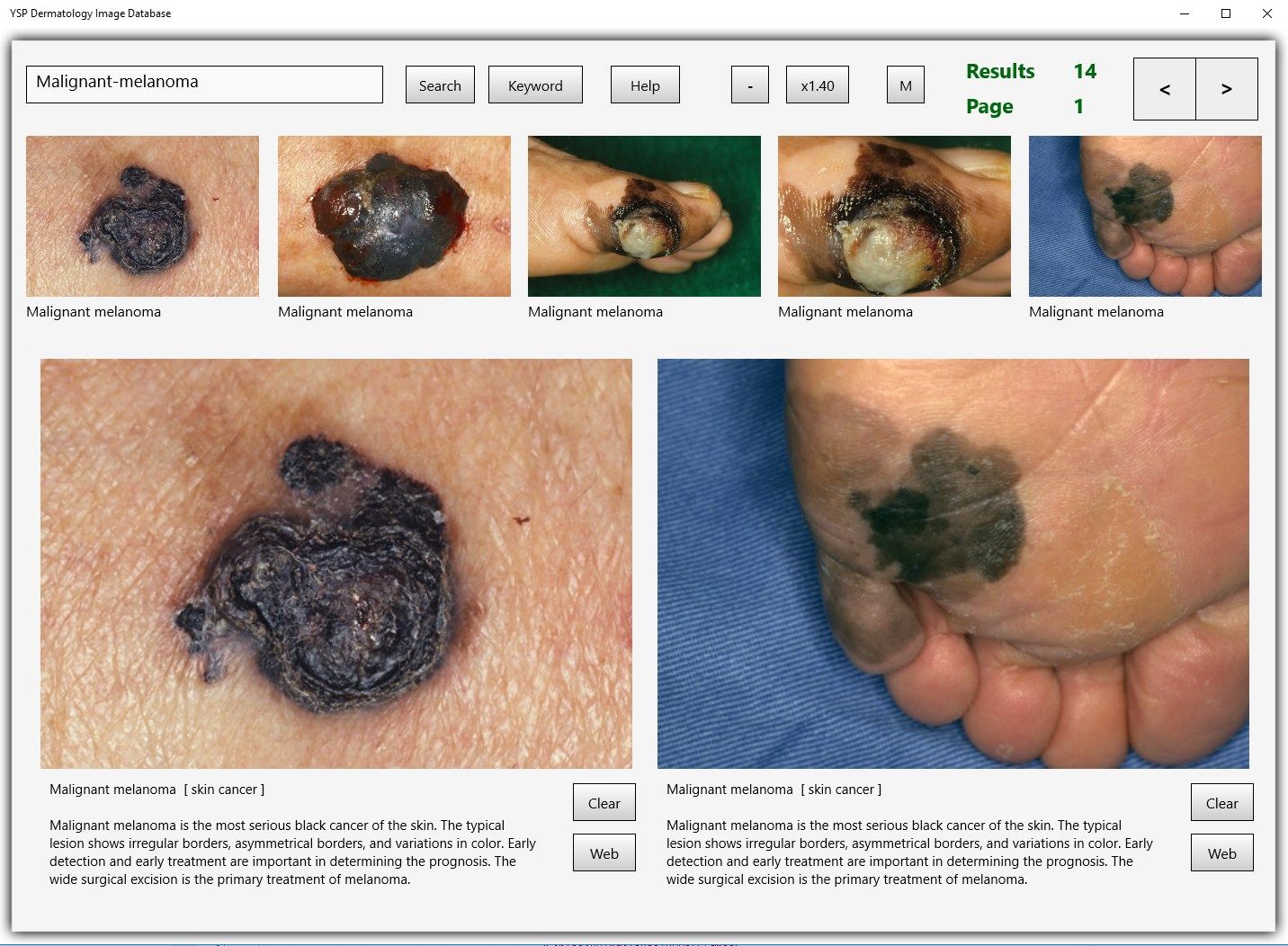 YSP Dermatology Image Database