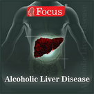 Alcoholic Liver Disease - An Overview