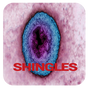 Shingles Disease