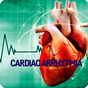 Cardiac Arrhytmia Disease