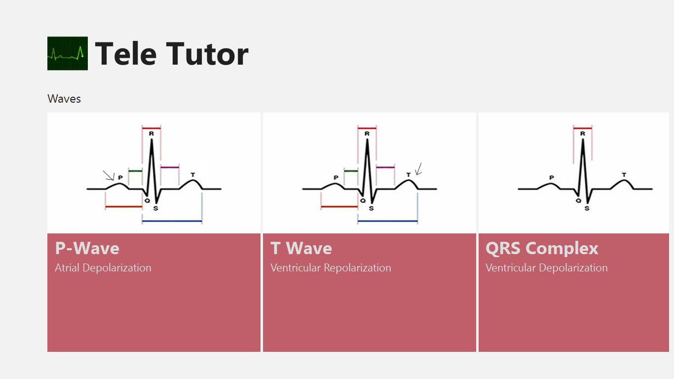 See wave definitions and the corresponding electrical activity.
