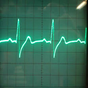 ECG