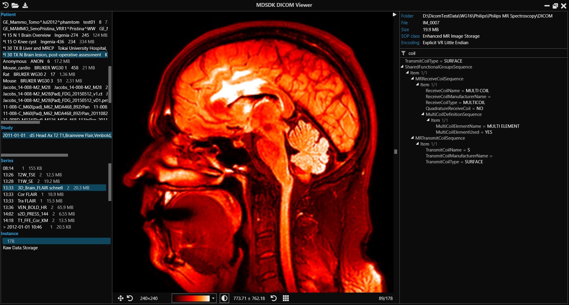 The main window of the MDSDK DICOM Viewer consists of a DICOM data browser on the left, a visualization panel in the middle, and a collapsible details view on the right.
