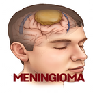 Meningioma Disease