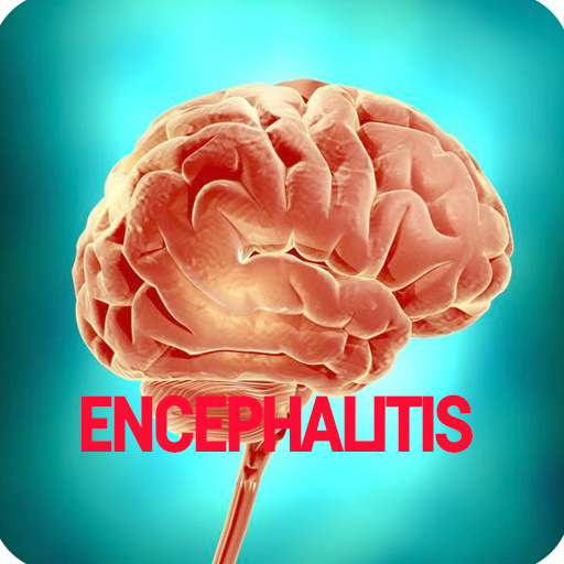 Encephalitis Disease