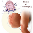 Diseases & Conditions (A-Z)