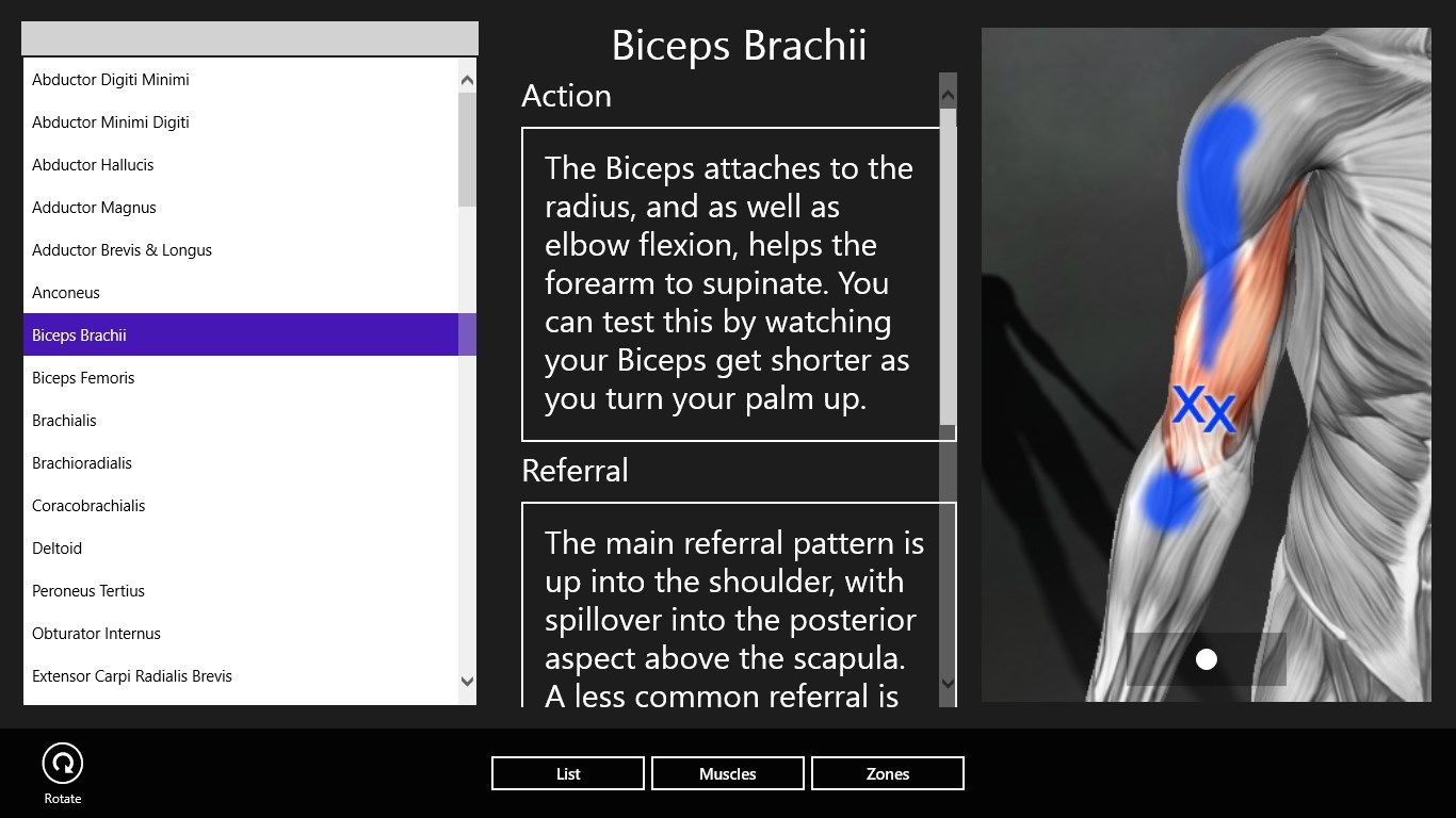 Anterior shoulder pain from biceps trigger points