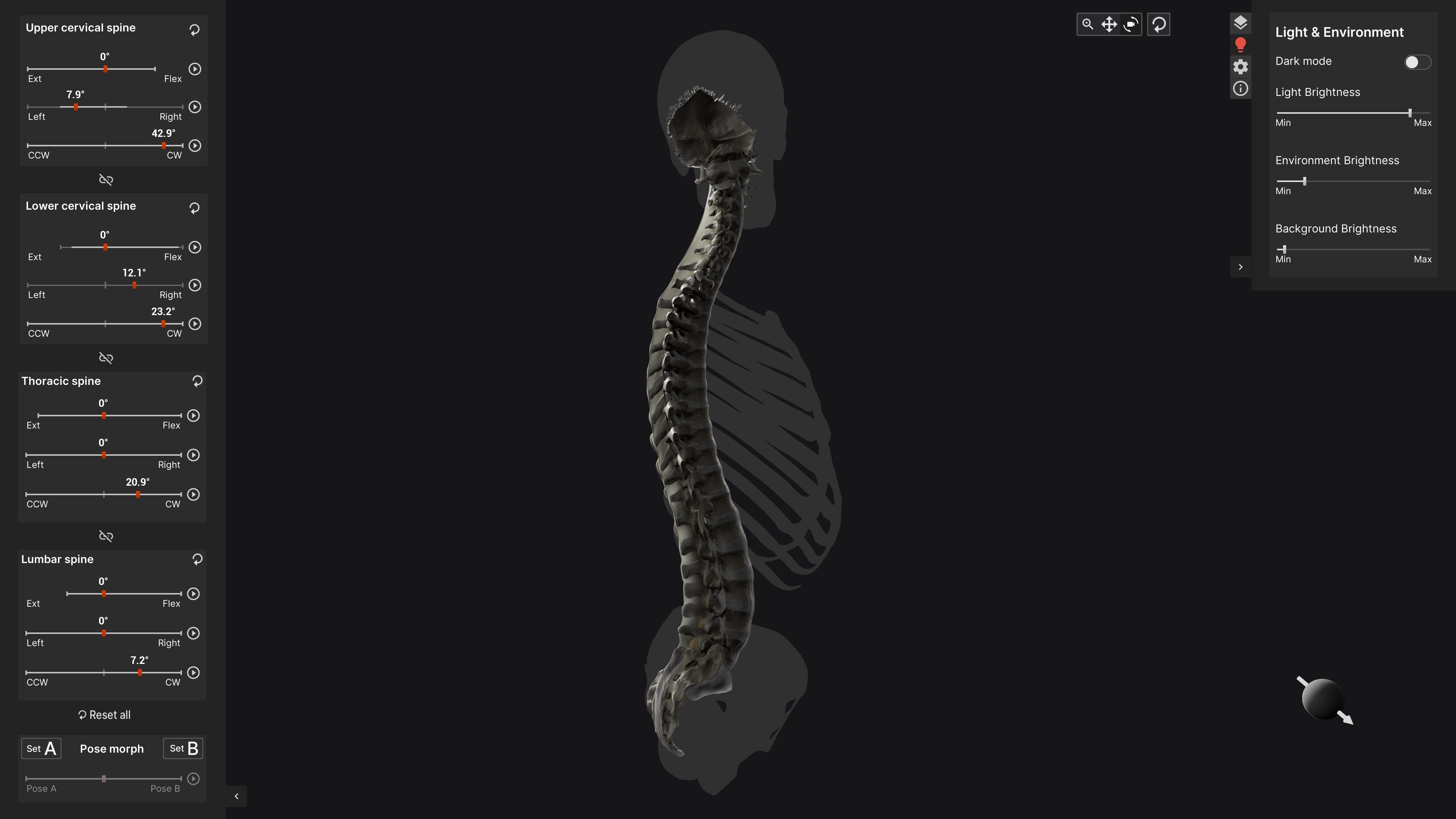 Biomechanics of the Spine