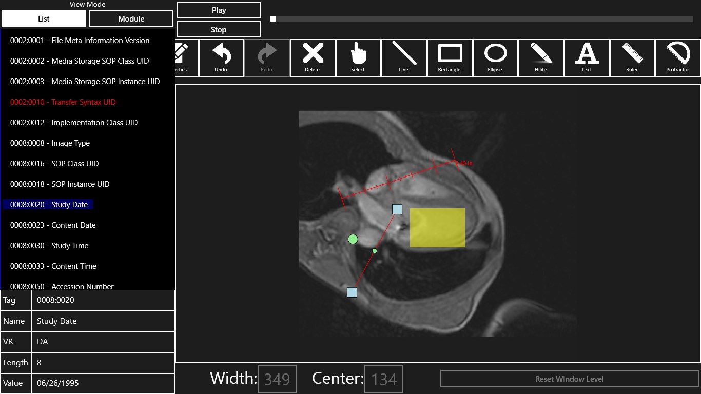 Add annotations to DICOM images