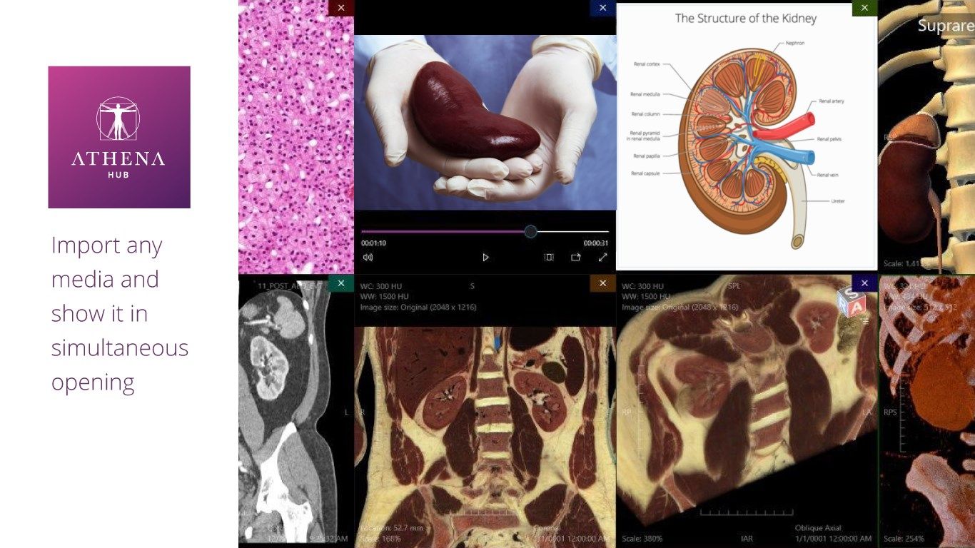 Virtual Cadaver Anatomy Lab - Athena Hub