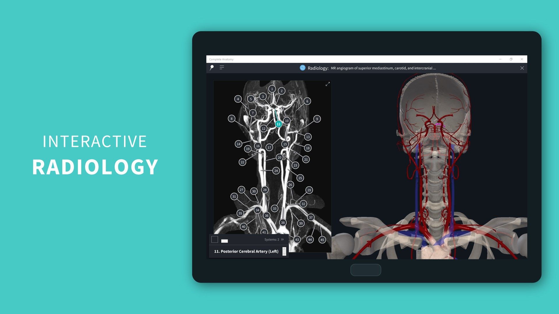 Correlate interactive radiological images with the 3D model